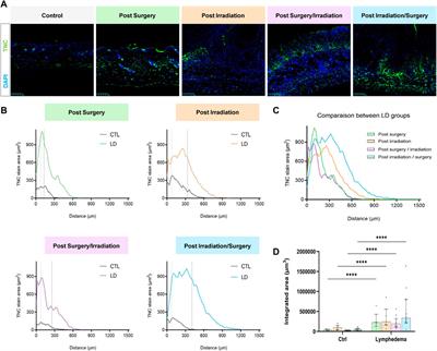 Single and combined impacts of irradiation and surgery on lymphatic vasculature and fibrosis associated to secondary lymphedema